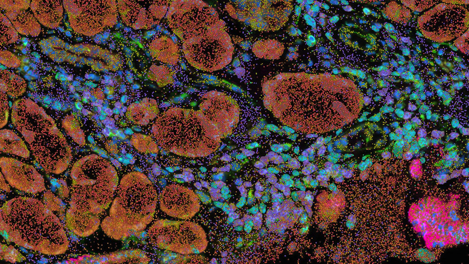 Fluorescent images of cells in orange, pink, purple, and green are shown on a black background