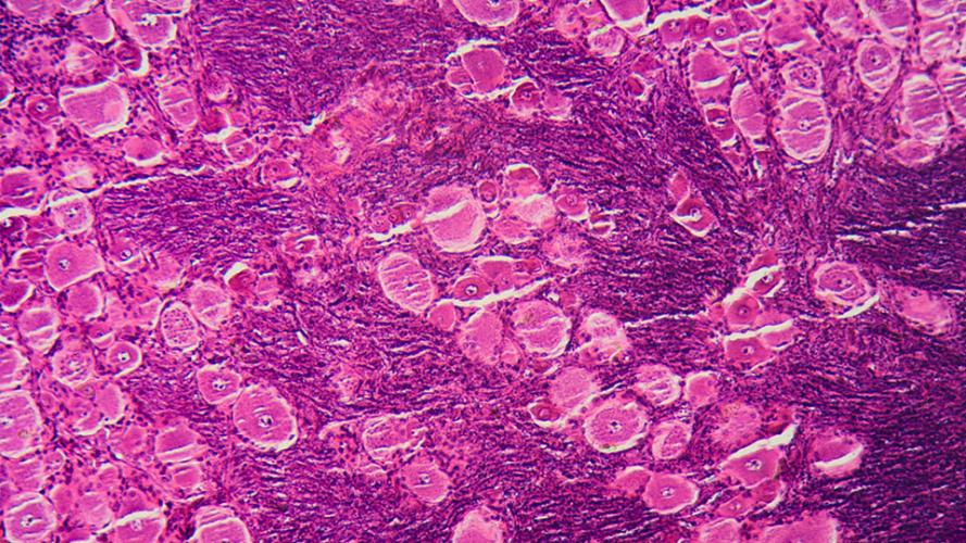 Microscopic image of pink tissue cells